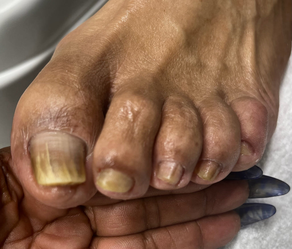 Foote Fixer | Nail Care By Sandra