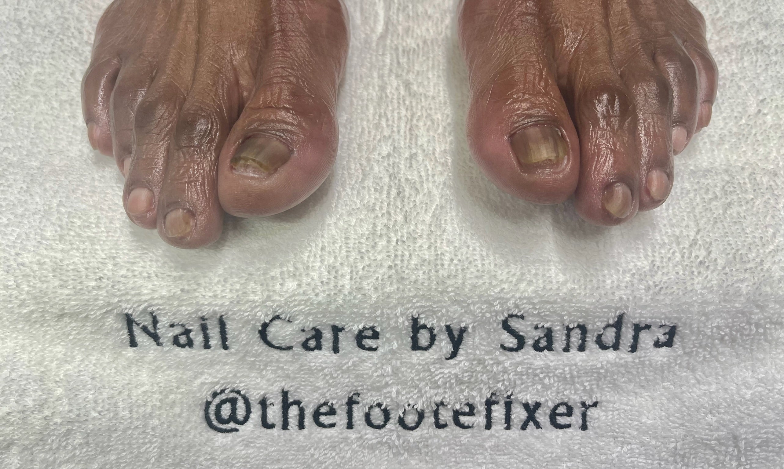 Foote Fixer | Nail Care By Sandra