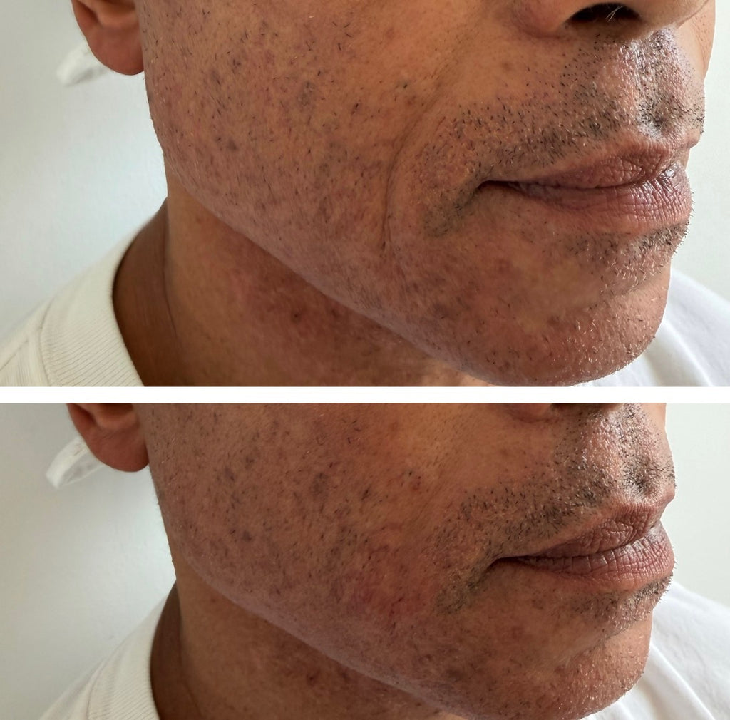 SKIN/tervention by Dr. Zoë Indigo, MD