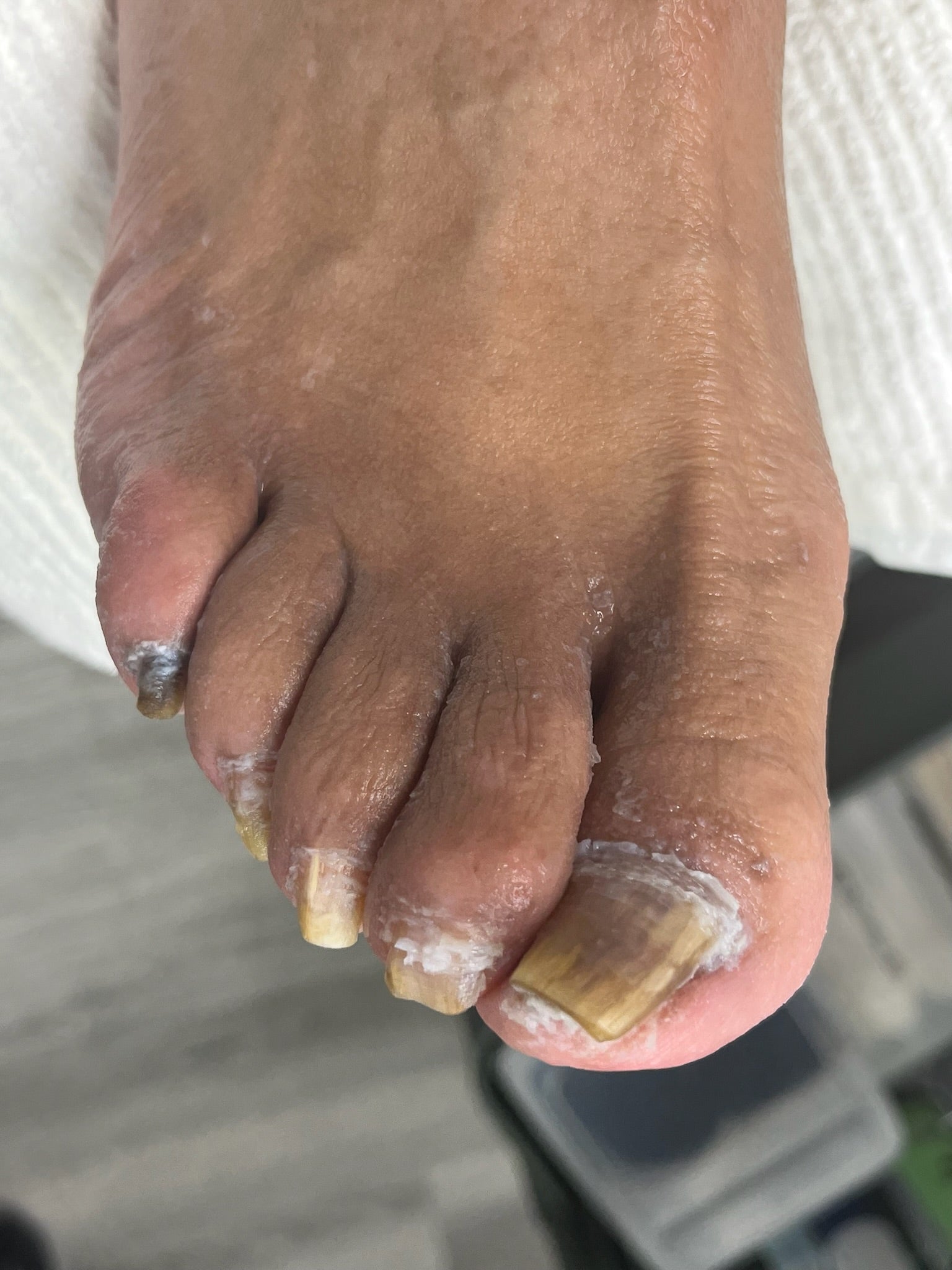 Foote Fixer | Nail Care By Sandra