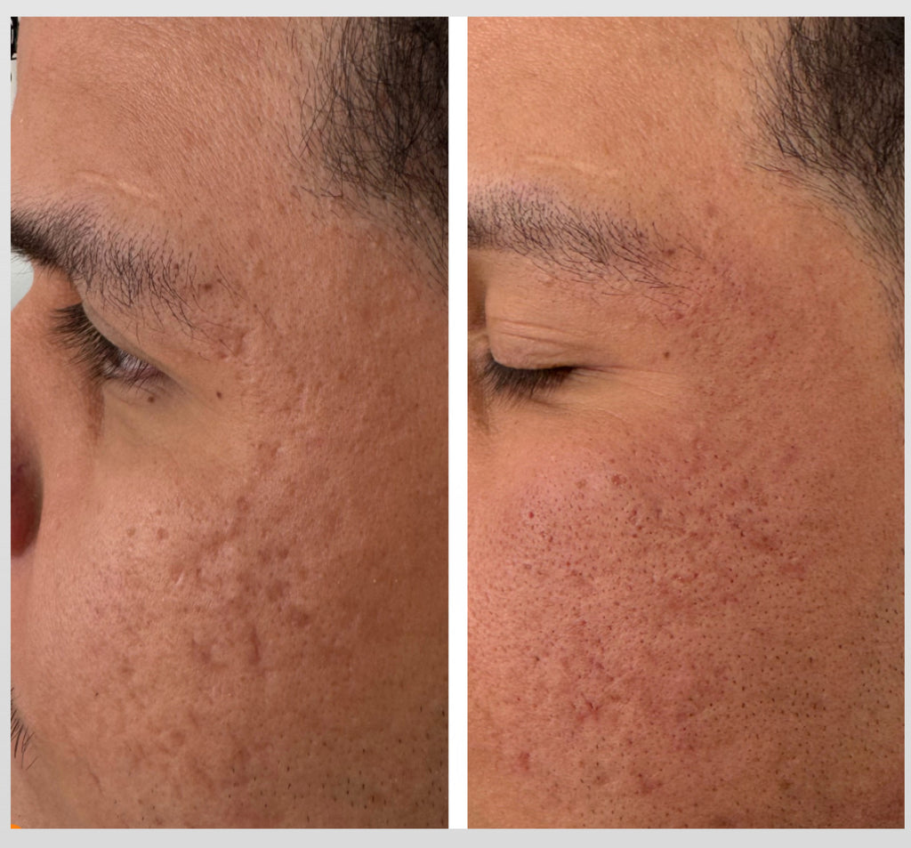 SKIN/tervention by Dr. Zoë Indigo, MD