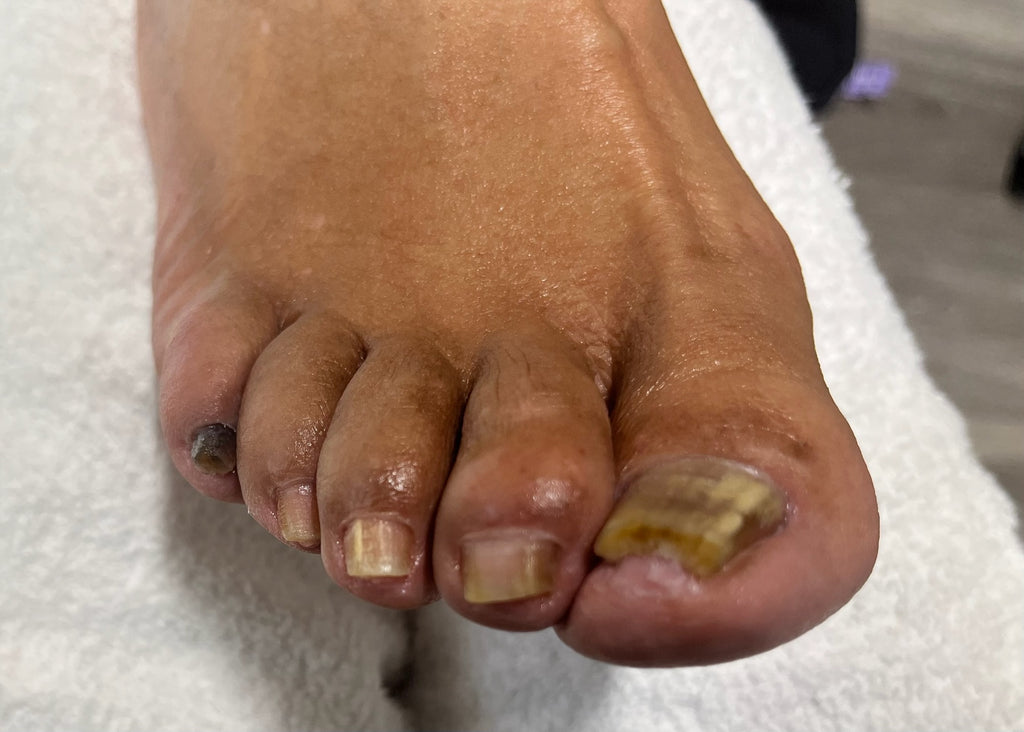Foote Fixer | Nail Care By Sandra