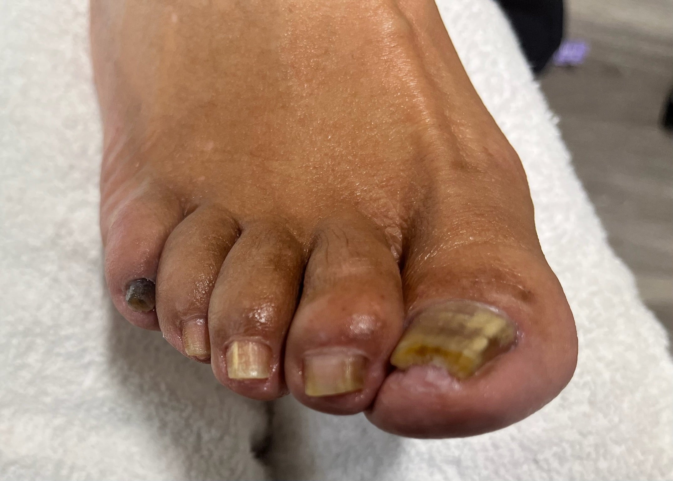 Foote Fixer | Nail Care By Sandra